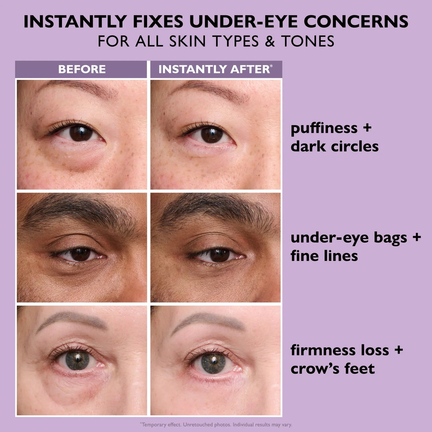 Final 3 Hours: 60%OFFđ„ Instant Eye Tightener Easy-Wear Formula With Brush Free!