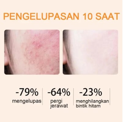 Orange Enzyme Exfoliating Gel — The Gentle Miracle Your Skin Has Been Crying Out For