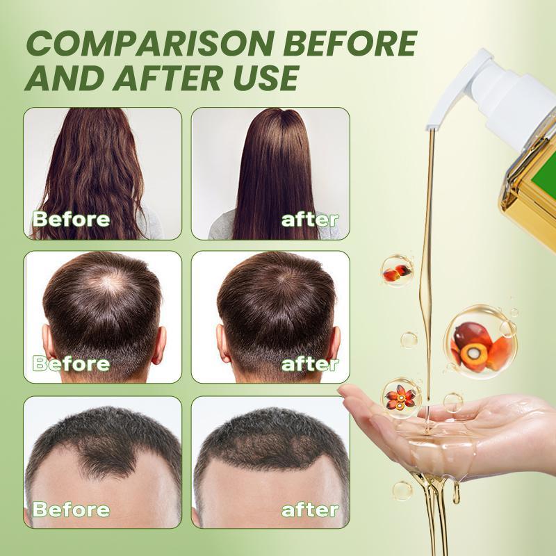Newyuo Batana Oil & Rosemary Shampoo - Nourishing Volumizing Shampoo for Men and Women - Cleanses the scalpļ¼Reduces hair loss, repairs damage and aids hair growth