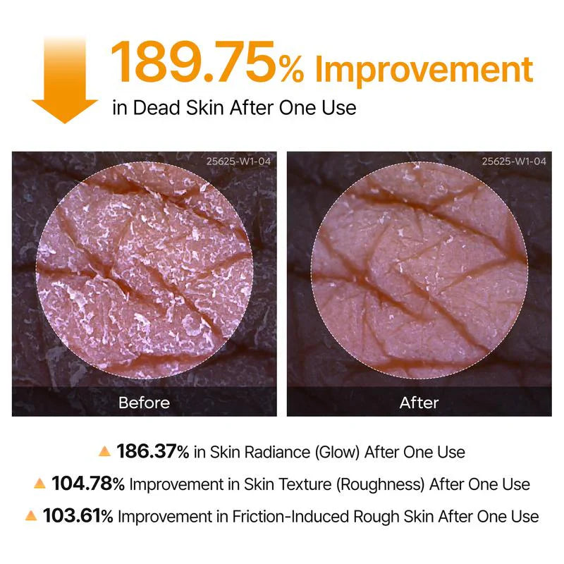 🔥【OFFICIAL STORE】Precise Care Kojic Acid Turmeric Spray 200ml
