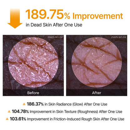 🔥【OFFICIAL STORE】Precise Care Kojic Acid Turmeric Spray 200ml