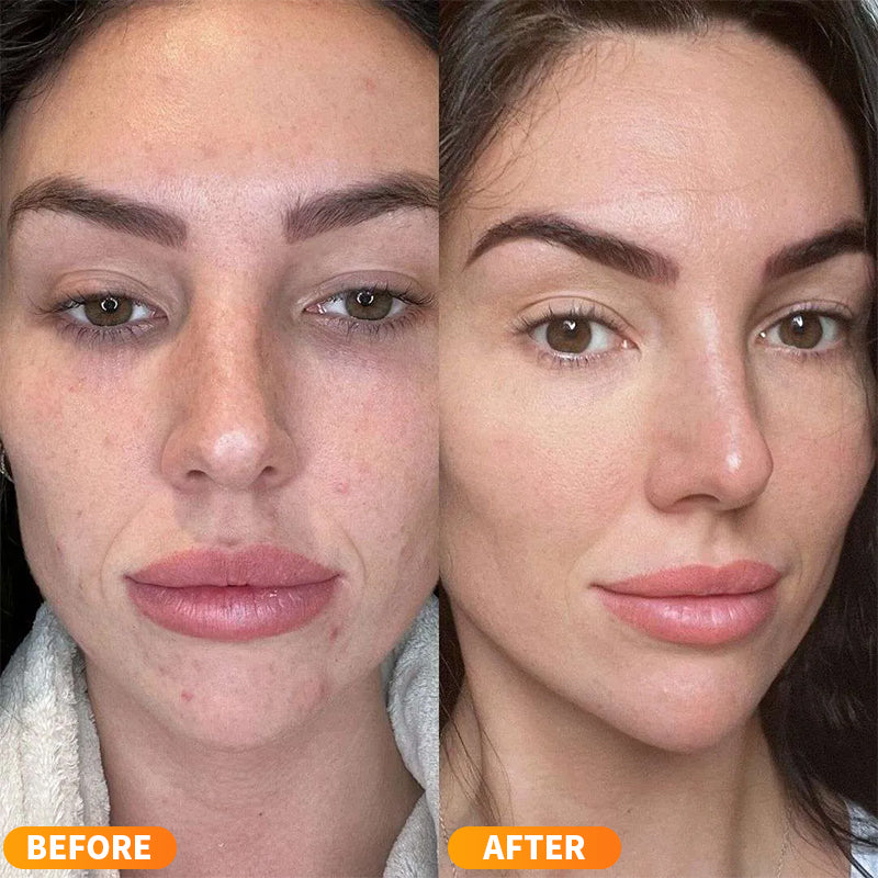 Newyuo™ Salmon PDRN Serum Wrinkles, Firmness & Hydration, Fragrance-Free, for All Skin Types
