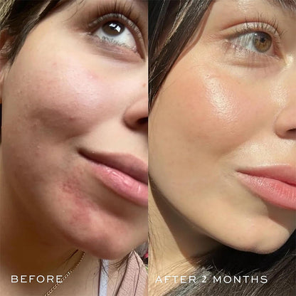 Newyuo™ Blue Facial Oil, Anti-Aging, Blemish & Breakout Control, For Normal, Combination & Oily Skin
